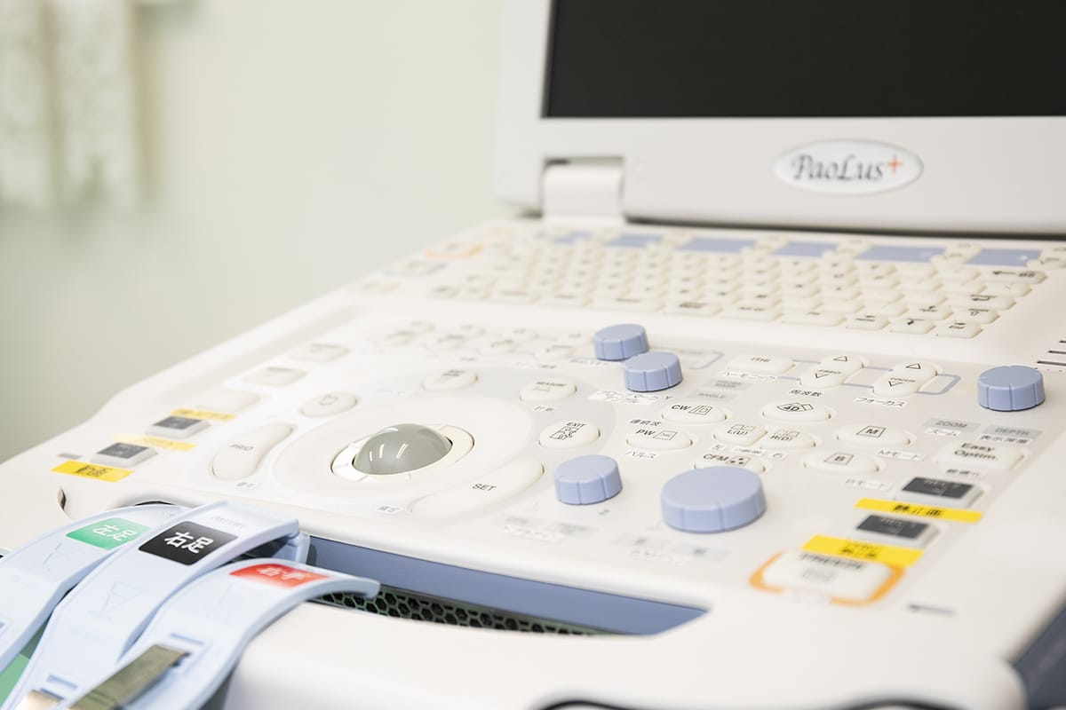 超音波診断装置（心臓、腹部、表在）